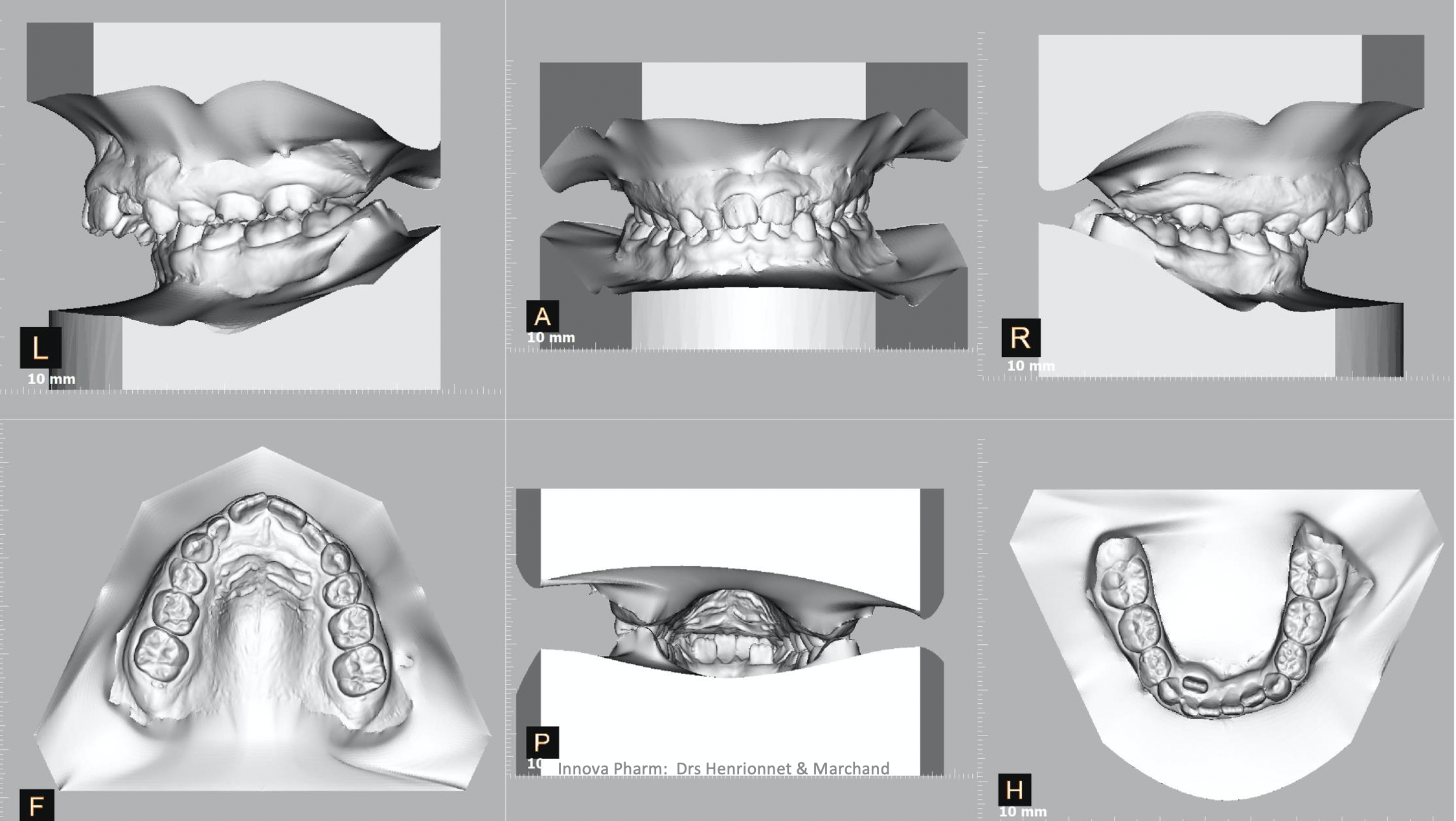 Radio sous plusieurs angles de la mâchoire